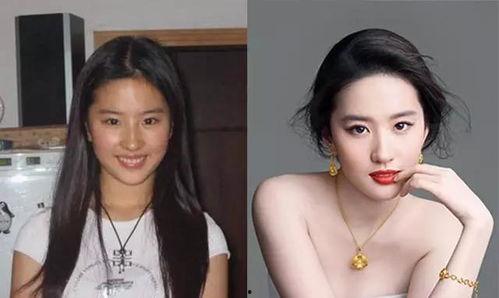 明星网红说做过吸脂,吸脂术背后的美丽蜕变之路