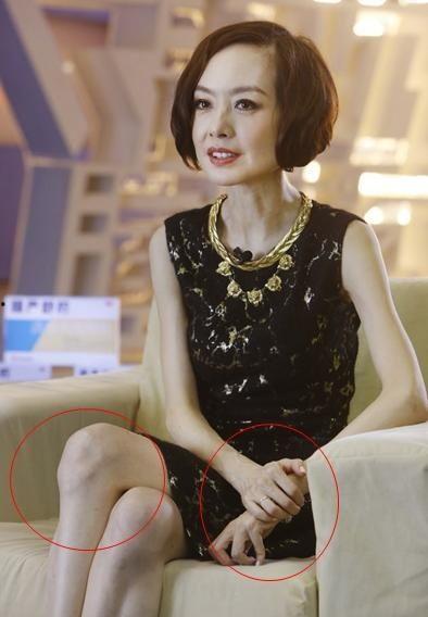 明星网红崴脚图片大全,盘点那些让人心疼的瞬间