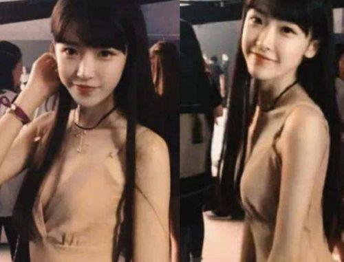 明星网红崴脚图片大全,盘点那些让人心疼的瞬间